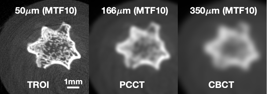 Resolution comparison showing TROI at 50 micrometers MTF10, PCCT at 166 micrometers MTF10, and CBCT at 350 micrometers MTF10.